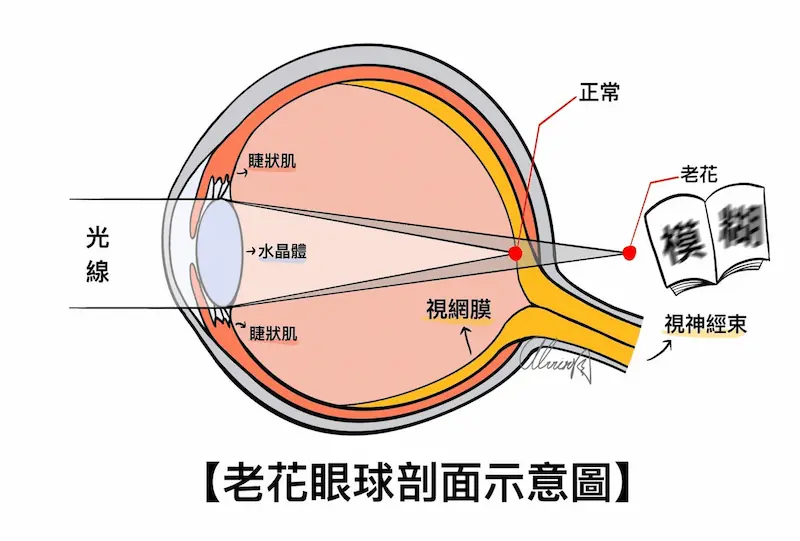 老花眼了嗎